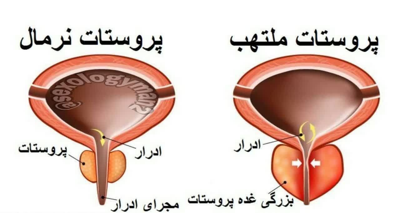 مشاوره و درمان مشکلات جنسی آقایان راستین طب در قشم
