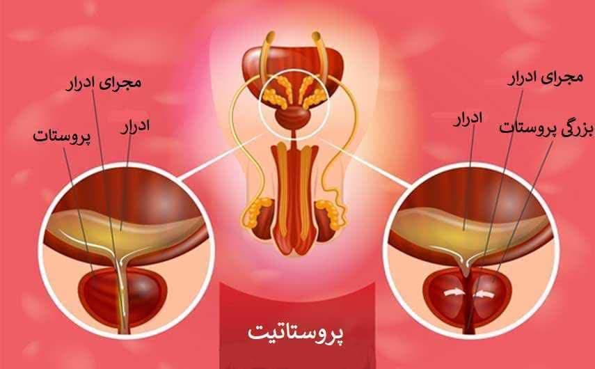 مشاوره و درمان مشکلات جنسی آقایان راستین طب در قشم