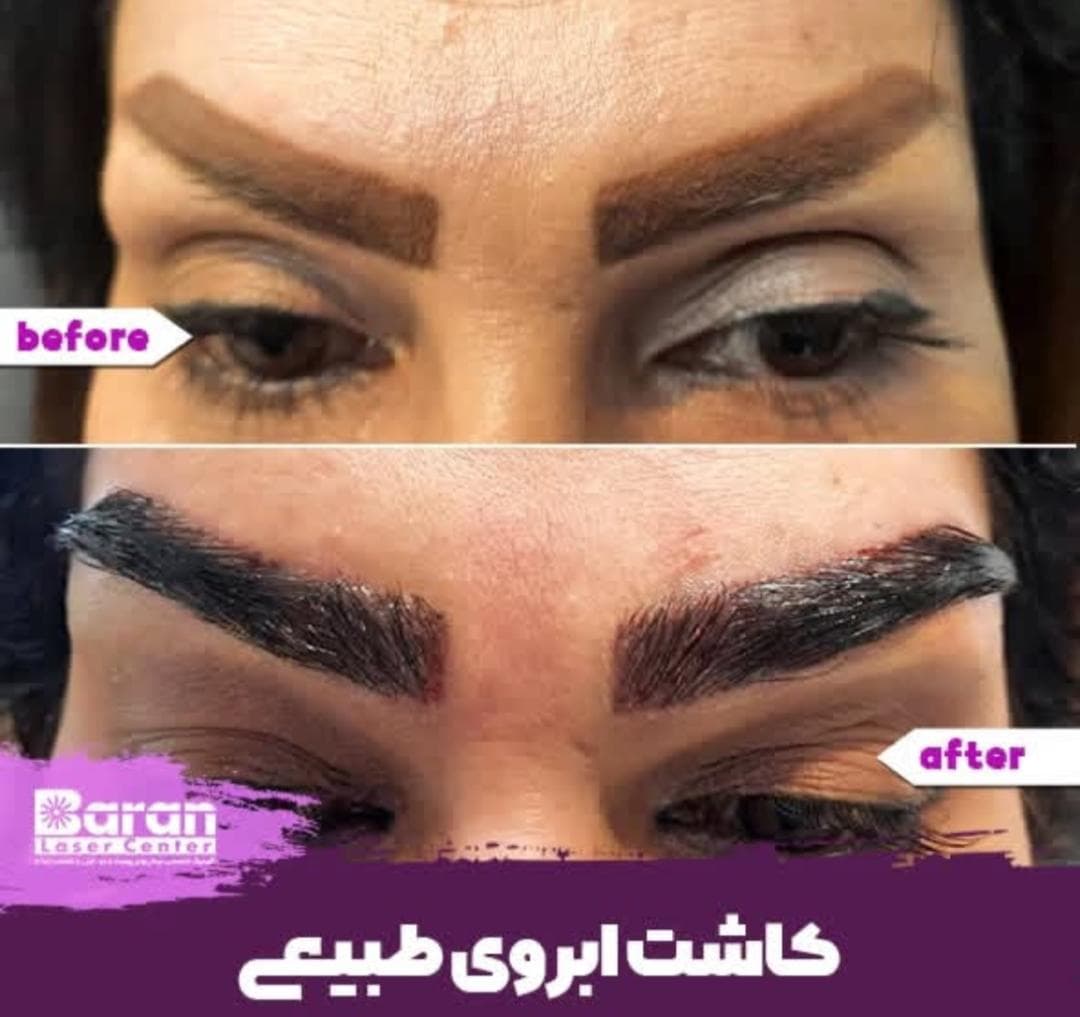کلینیک تخصصی پوست و مو باران در شیخ صدوق شمالی اصفهان