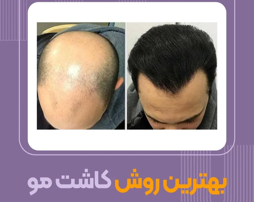 کلینیک تخصصی پوست و مو باران در شیخ صدوق شمالی اصفهان