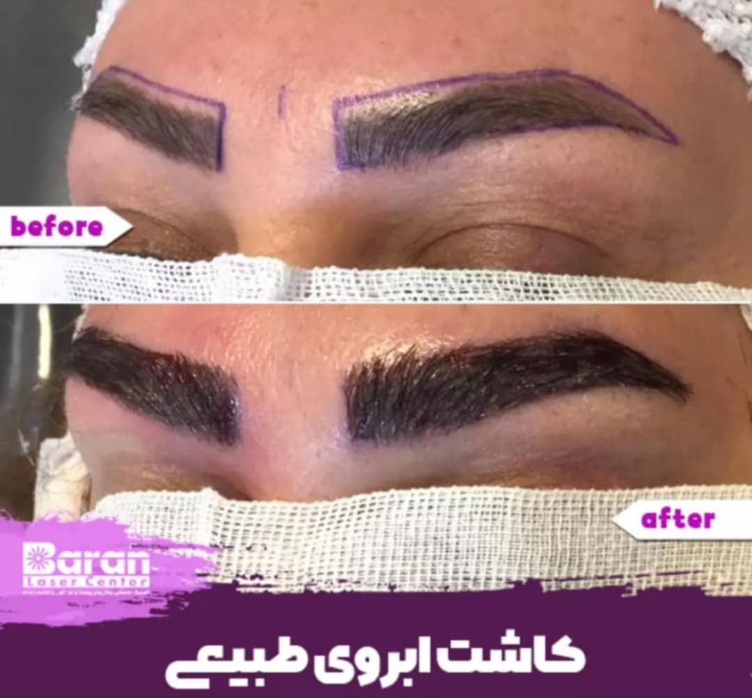 کلینیک تخصصی پوست و مو باران در شیخ صدوق شمالی اصفهان