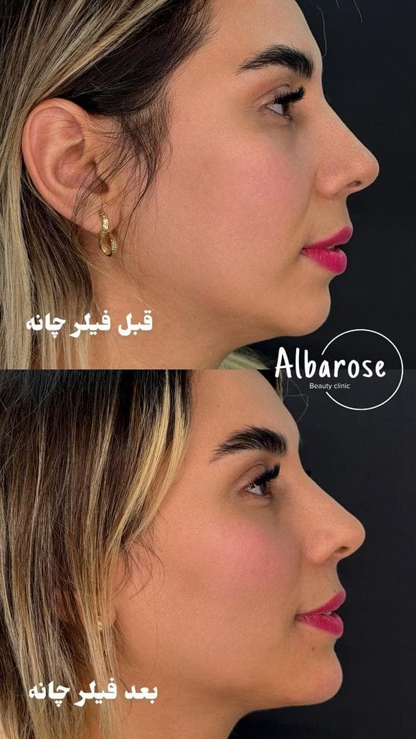 مطب زیبایی آلبارز در قلیپور رشت