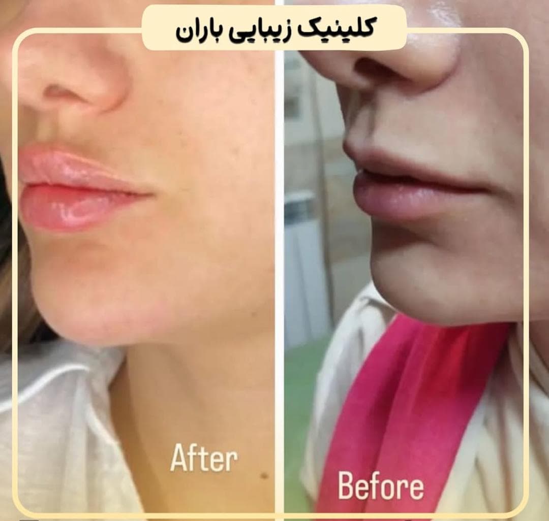 کلینیک تخصصی پوست و مو باران در شیخ صدوق شمالی اصفهان
