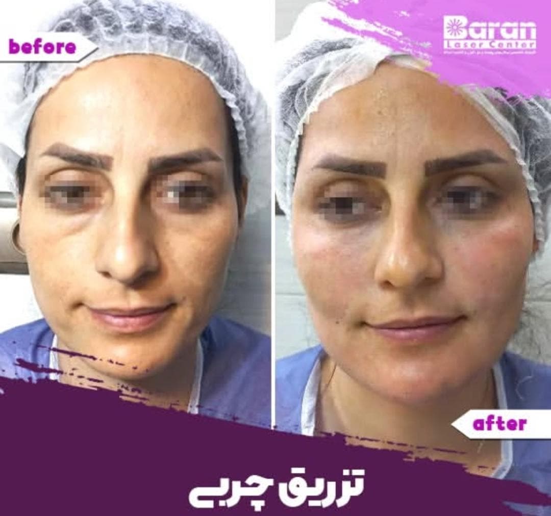 کلینیک تخصصی پوست و مو باران در شیخ صدوق شمالی اصفهان