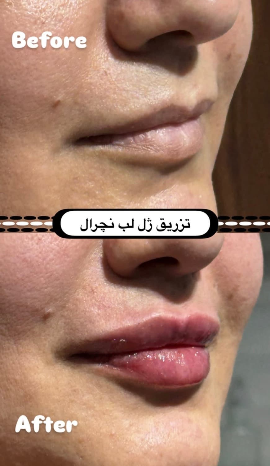 کلینیک زیبایی کوروش در کرج