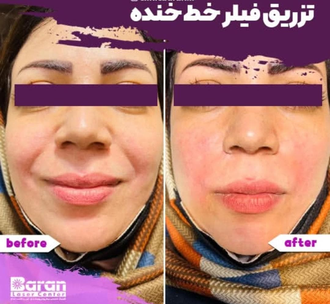 کلینیک تخصصی پوست و مو باران در شیخ صدوق شمالی اصفهان