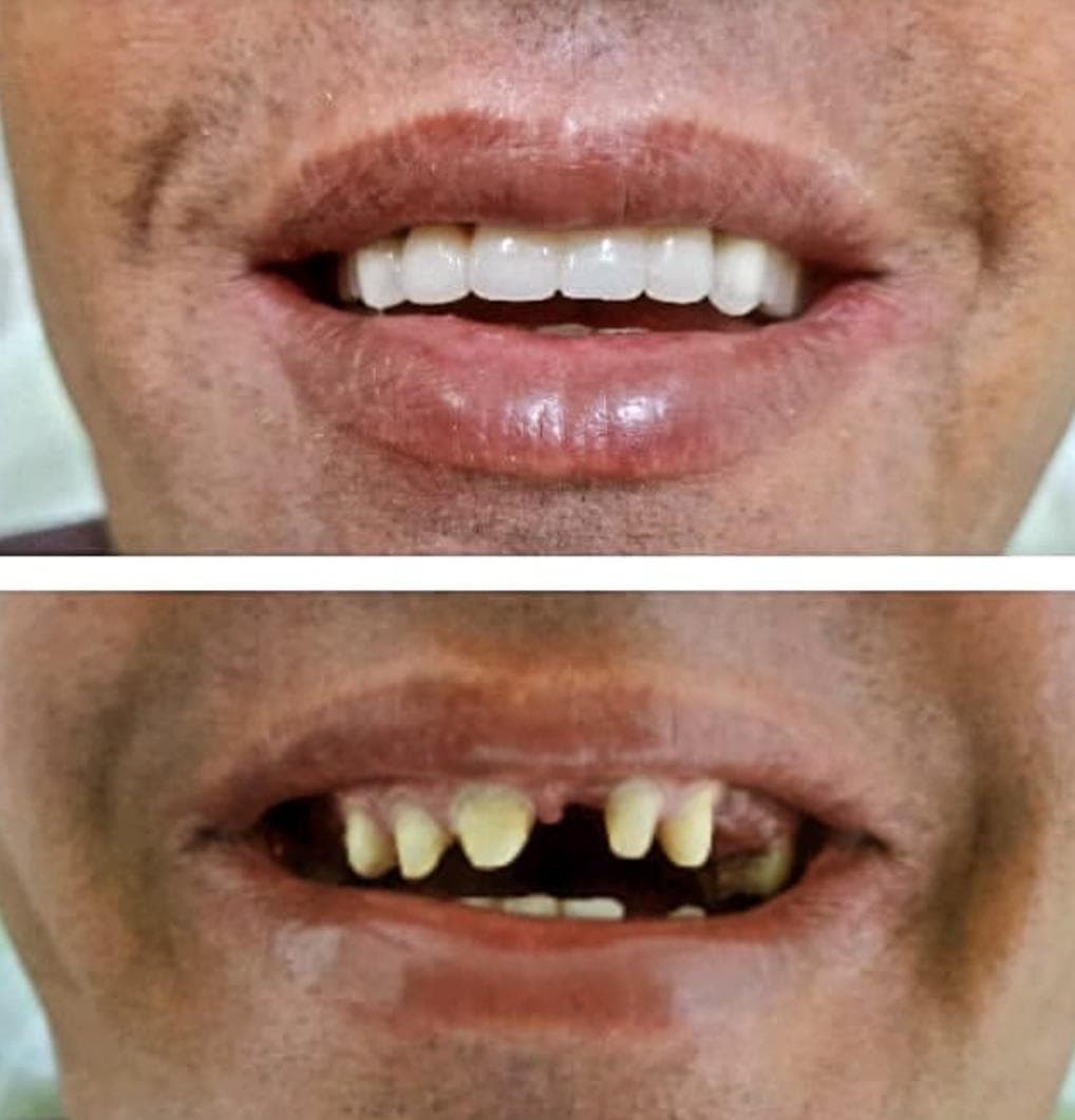 مطب دندانپزشکی دکتر علیرضا گلشنی در هفده شهریور جدید تبریز