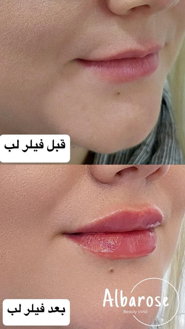 مطب زیبایی آلبارز در قلیپور رشت