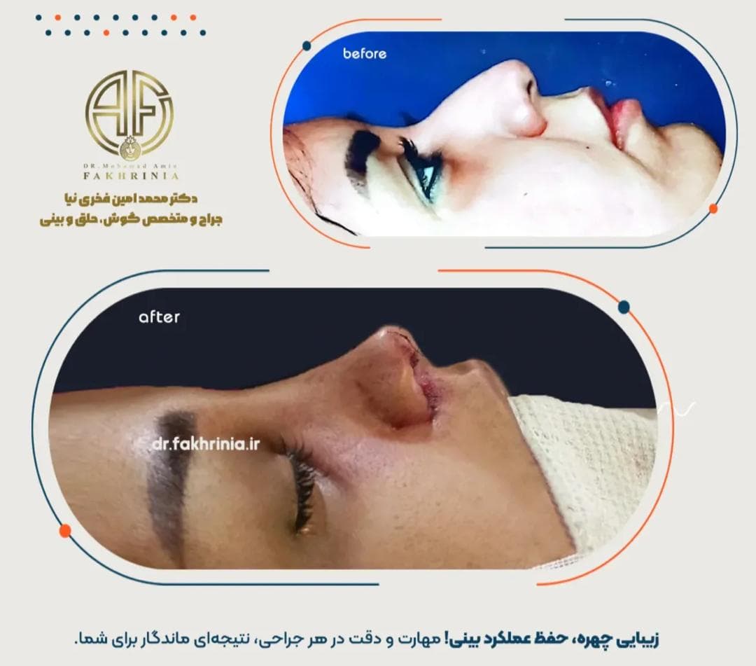 مطب جراح زیبایی بینی و صورت دکتر محمد امین فخری نیا در قصرالدشت شیراز