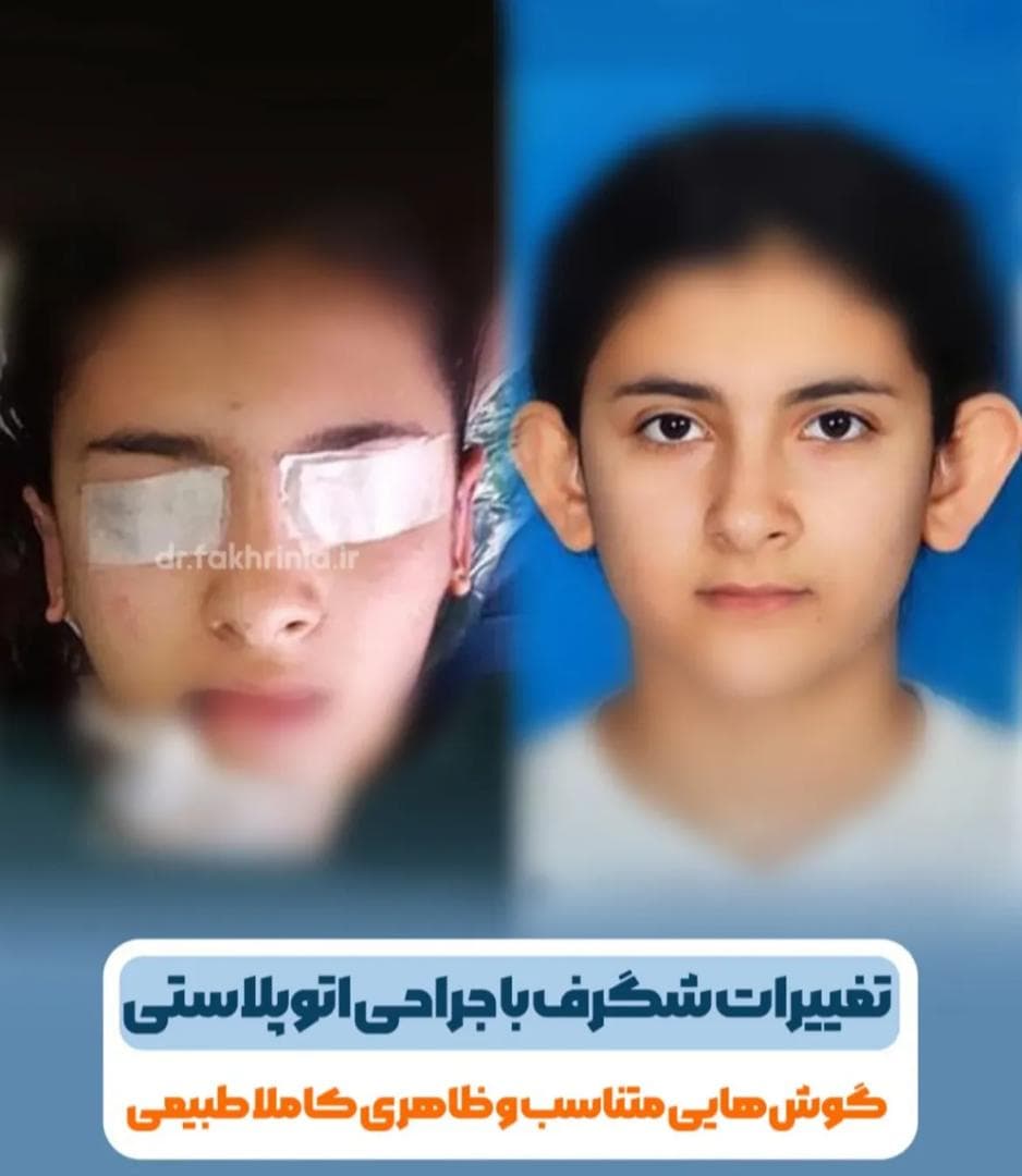مطب جراح زیبایی بینی و صورت دکتر محمد امین فخری نیا در قصرالدشت شیراز