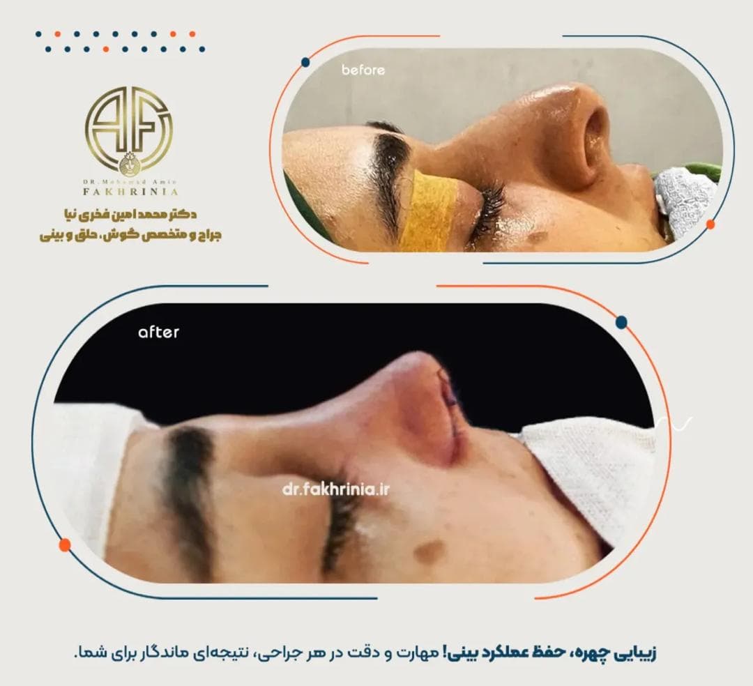 مطب جراح زیبایی بینی و صورت دکتر محمد امین فخری نیا در قصرالدشت شیراز