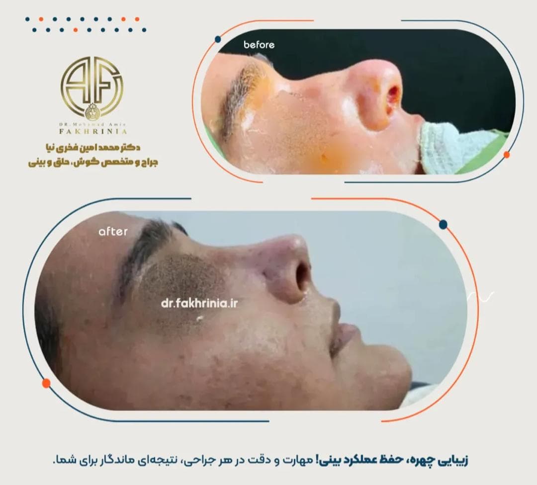 مطب جراح زیبایی بینی و صورت دکتر محمد امین فخری نیا در قصرالدشت شیراز