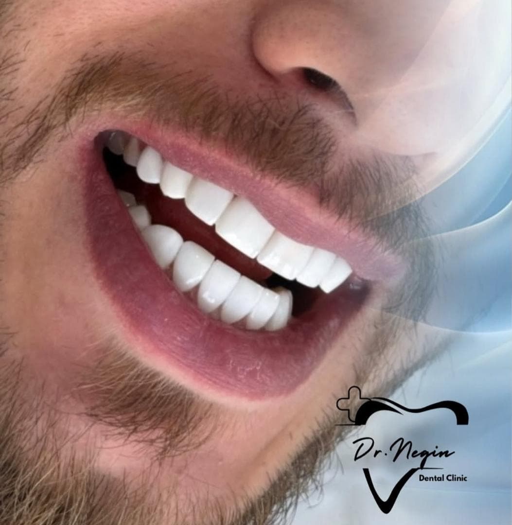 مطب دندانپزشکی نگین دنتال در راهنمایی مشهد