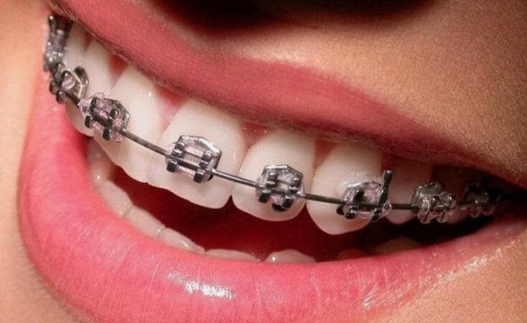 مطب دندانپزشکی دکتر عبدالرضا شریفی در سپاه تهران