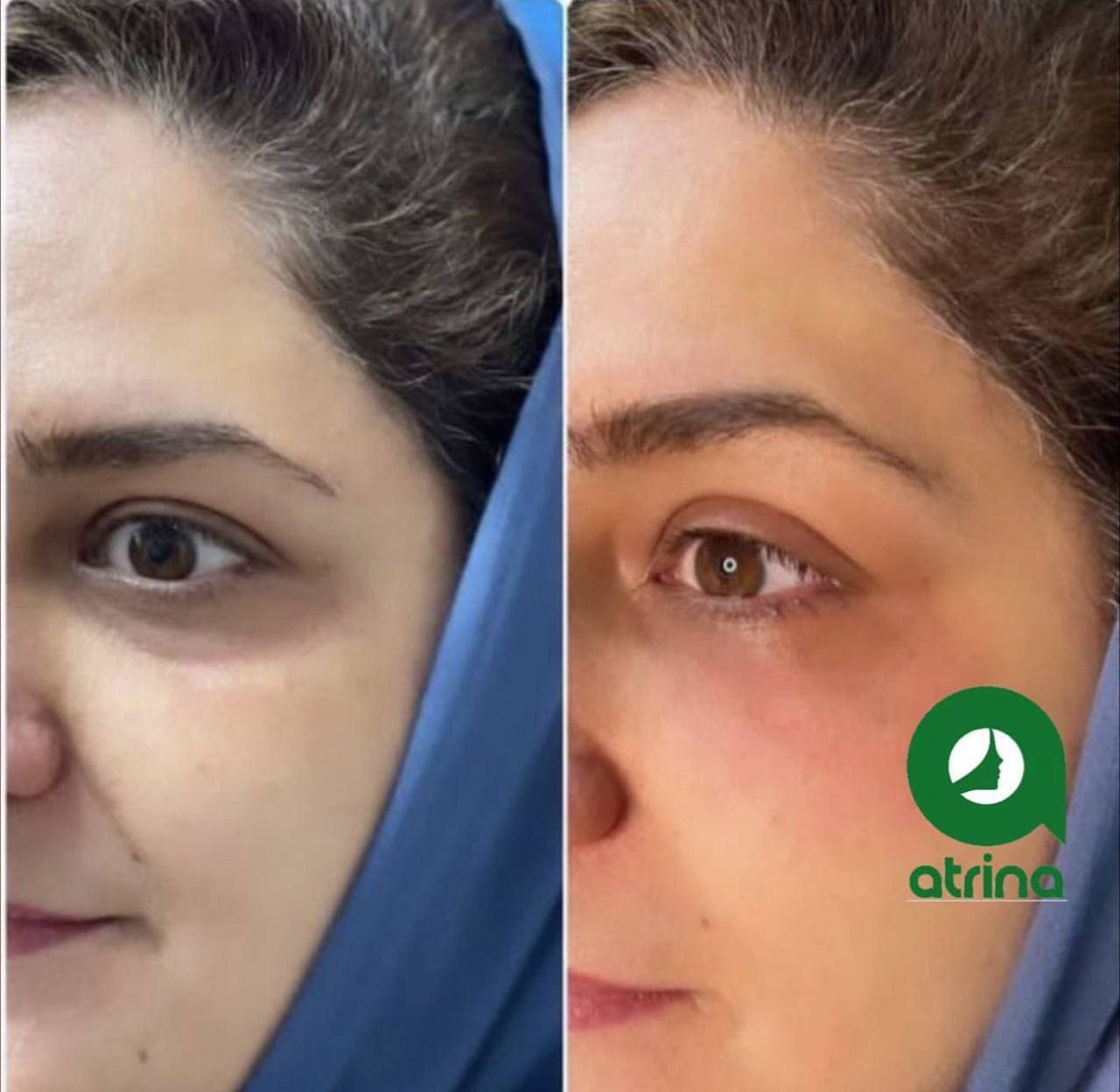 کلینیک زیبایی آترینا در باغ فیض اسلامشهر