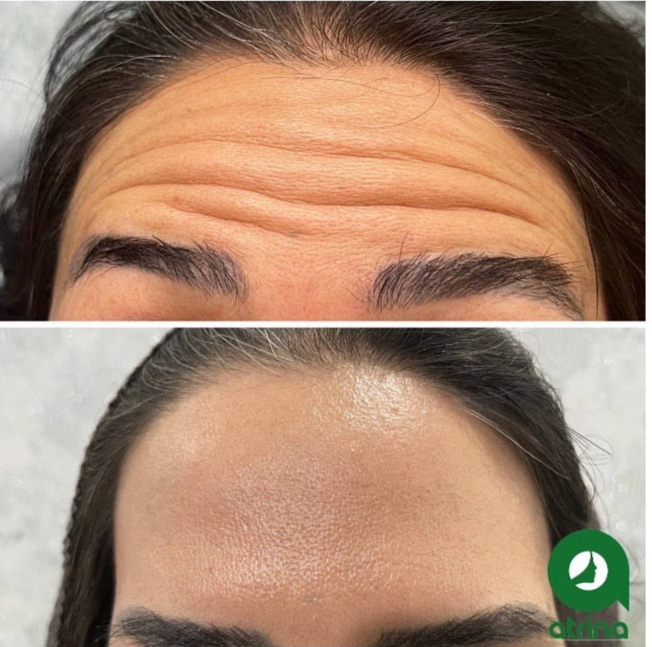 کلینیک زیبایی آترینا در باغ فیض اسلامشهر