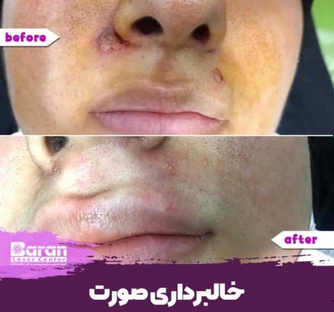 کلینیک تخصصی پوست و مو باران در شیخ صدوق شمالی اصفهان