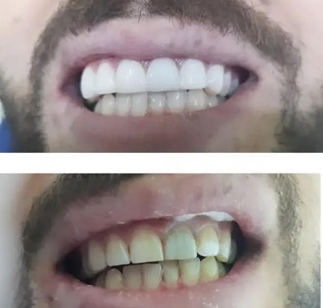 مطب دندانپزشکی دکتر علیرضا گلشنی در هفده شهریور جدید تبریز
