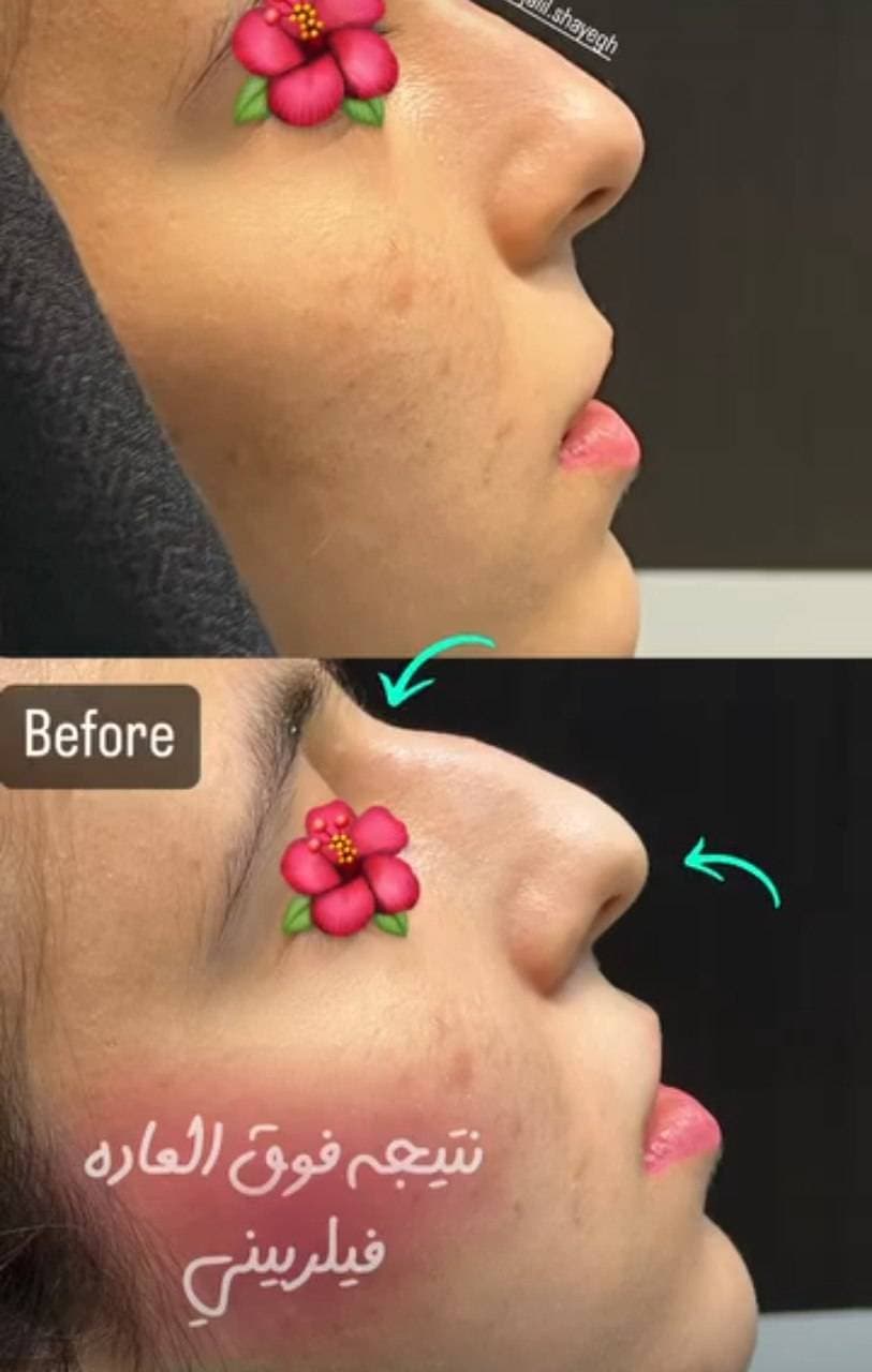کلینیک تخصصی تزریق فیلر و بوتاکس دکتر جلیل شایق در یزد