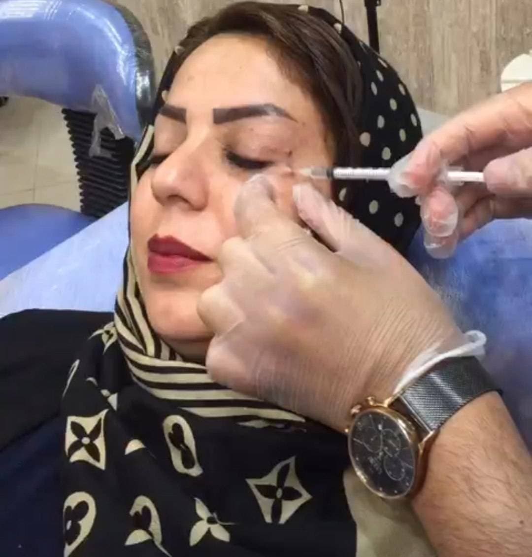 کلینیک تخصصی تزریق فیلر و بوتاکس دکتر جلیل شایق در یزد