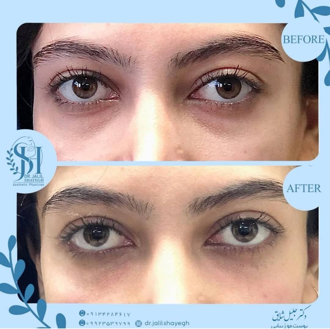 کلینیک تخصصی تزریق فیلر و بوتاکس دکتر جلیل شایق در یزد