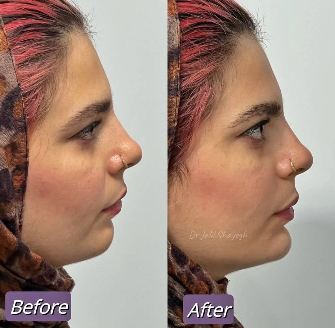 کلینیک تخصصی تزریق فیلر و بوتاکس دکتر جلیل شایق در یزد