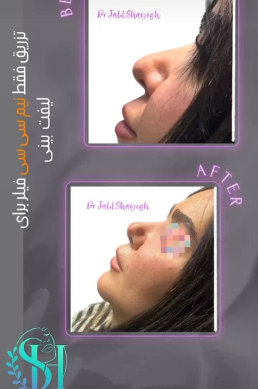 کلینیک تخصصی تزریق فیلر و بوتاکس دکتر جلیل شایق در یزد