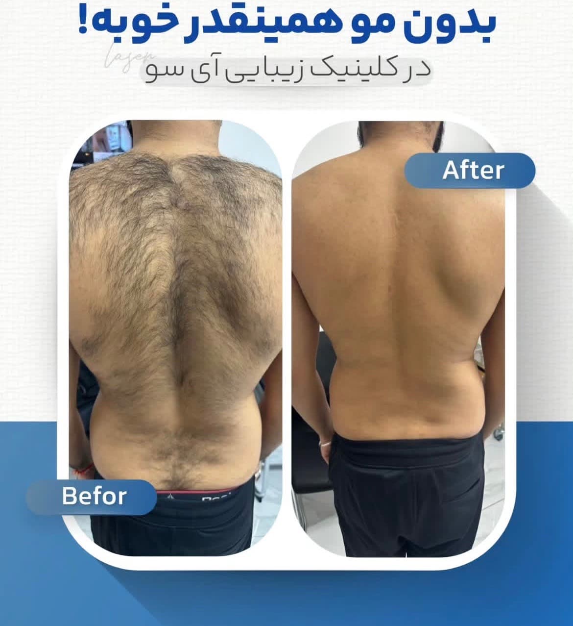 مطب زیبایی آی سو در ولیعصر تبریز