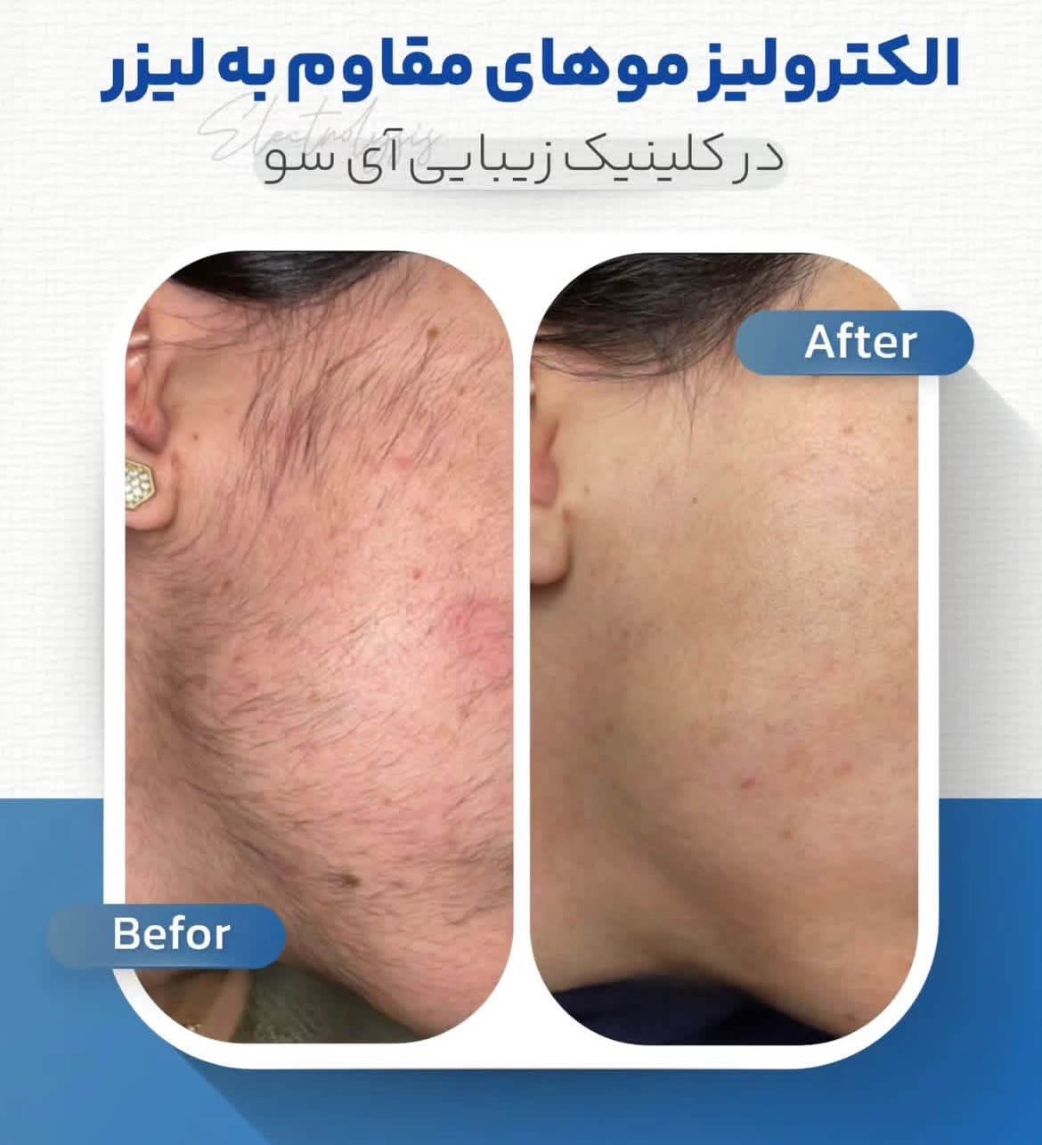 مطب زیبایی آی سو در ولیعصر تبریز