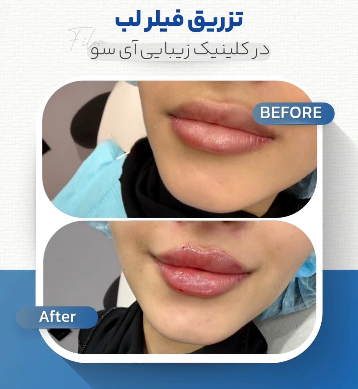 مطب زیبایی آی سو در ولیعصر تبریز