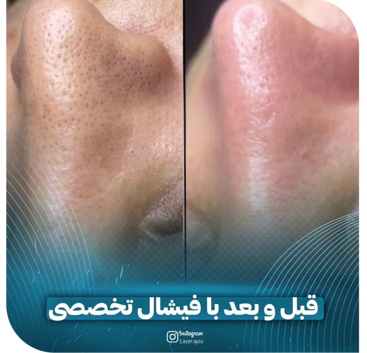 مطب زیبایی آی سو در ولیعصر تبریز