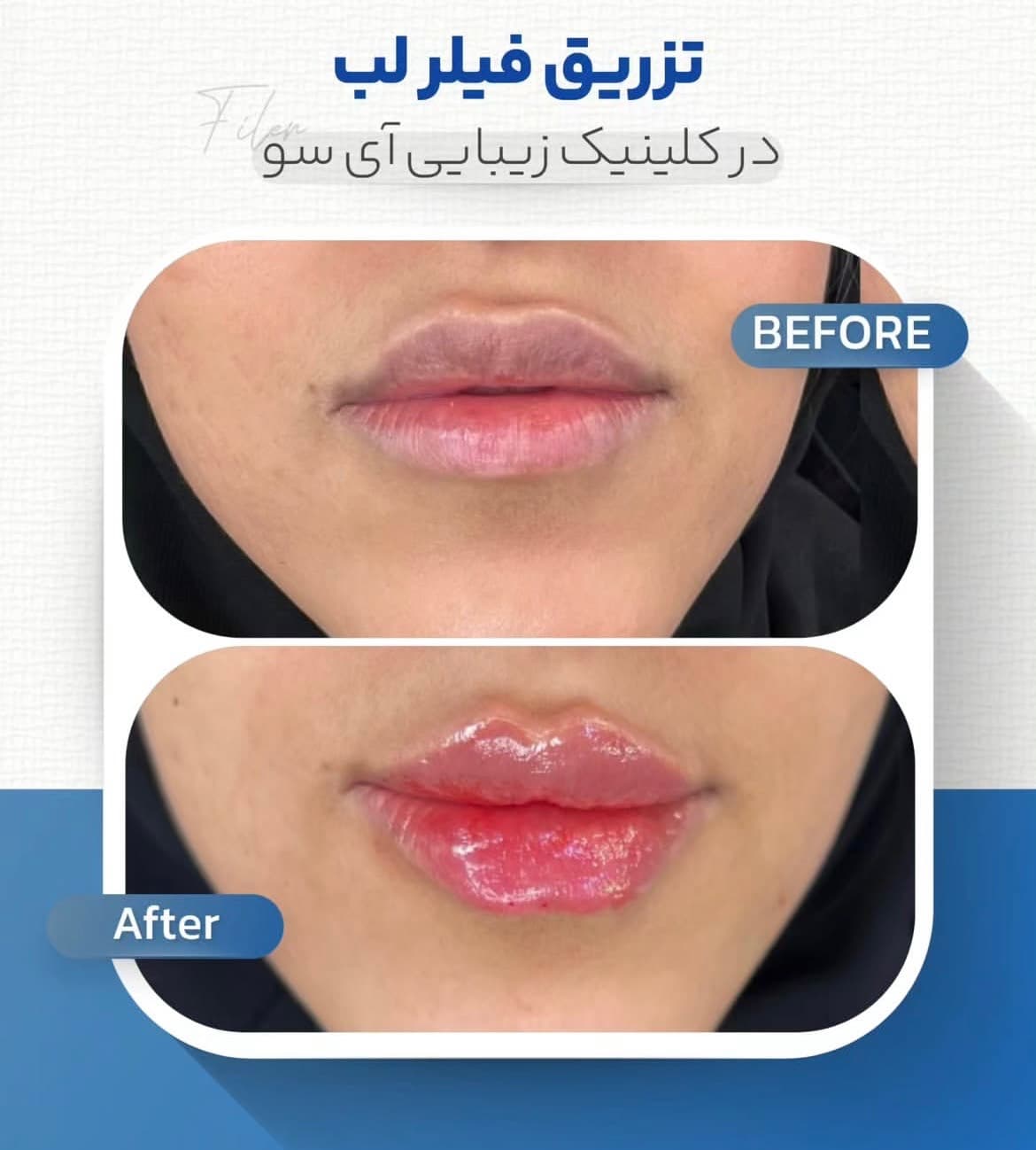 مطب زیبایی آی سو در ولیعصر تبریز