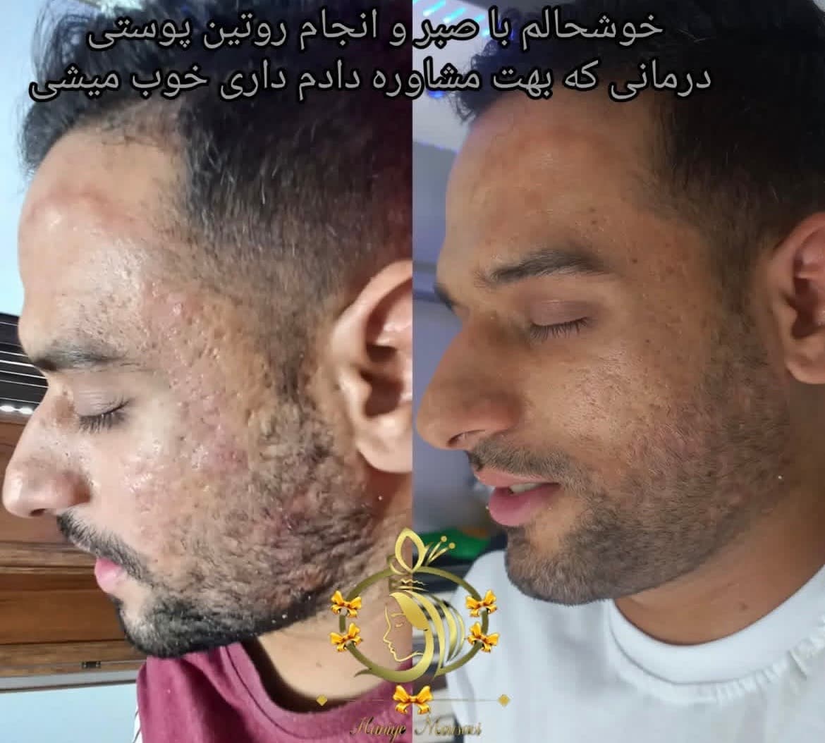 کلینیک زیبایی قوی سفید در مشهد