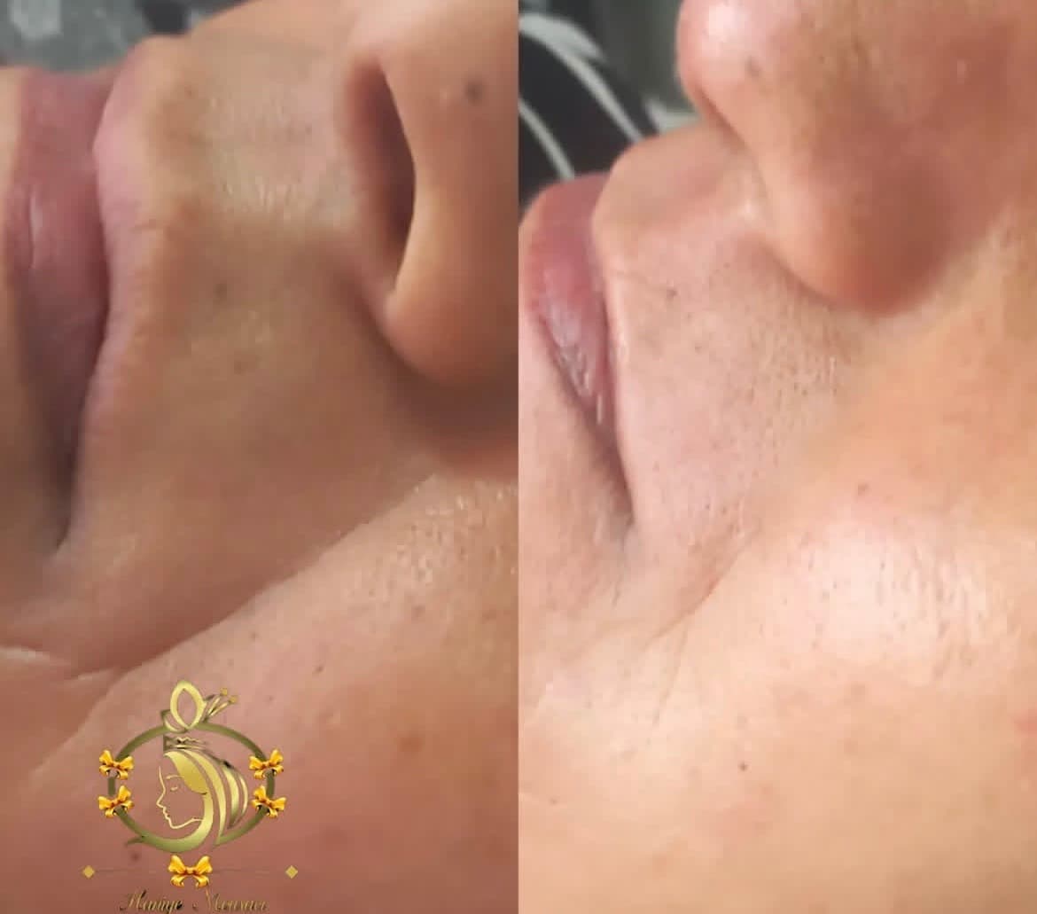 کلینیک زیبایی قوی سفید در مشهد