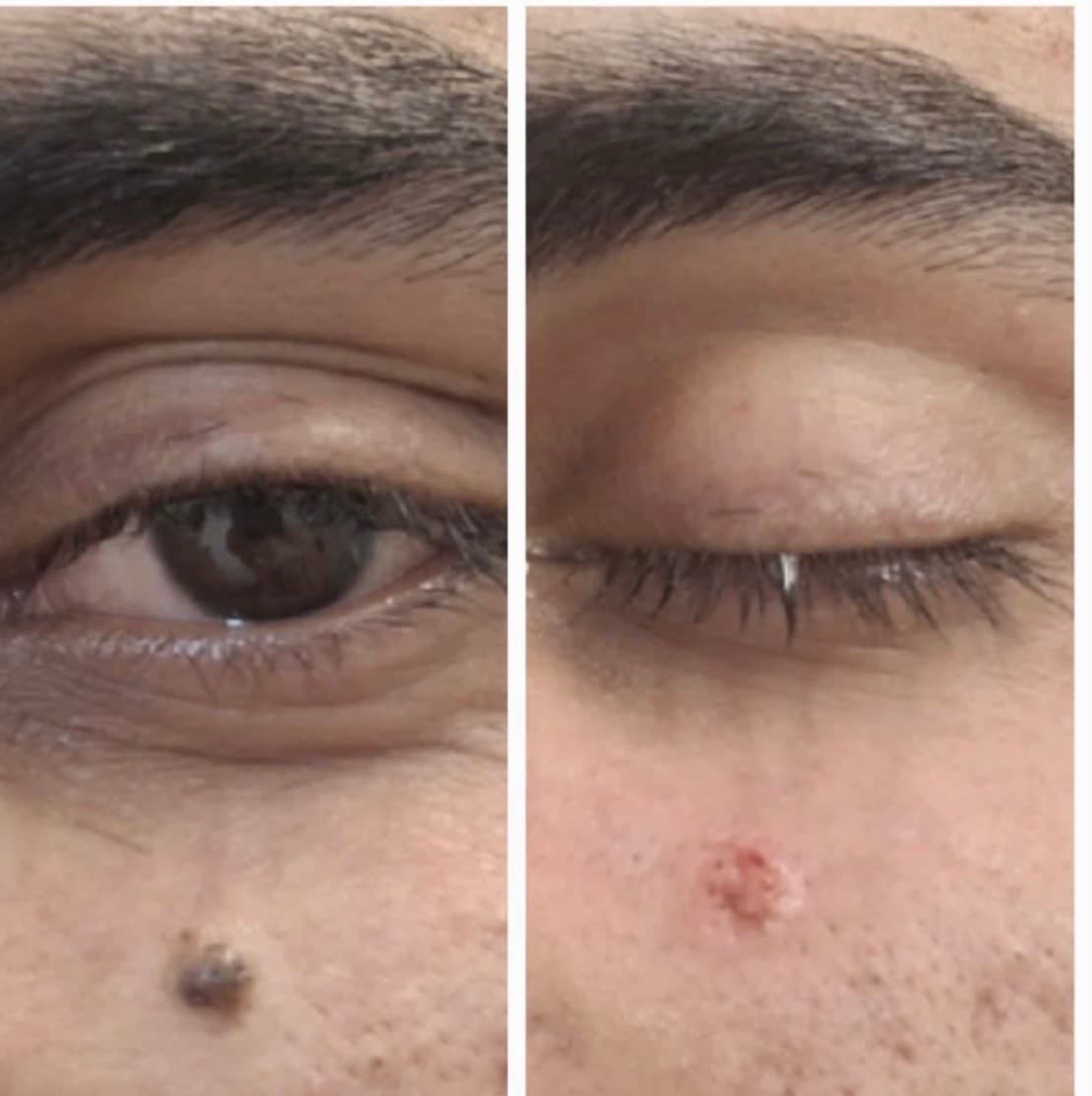 کلینیک زیبایی قوی سفید در مشهد