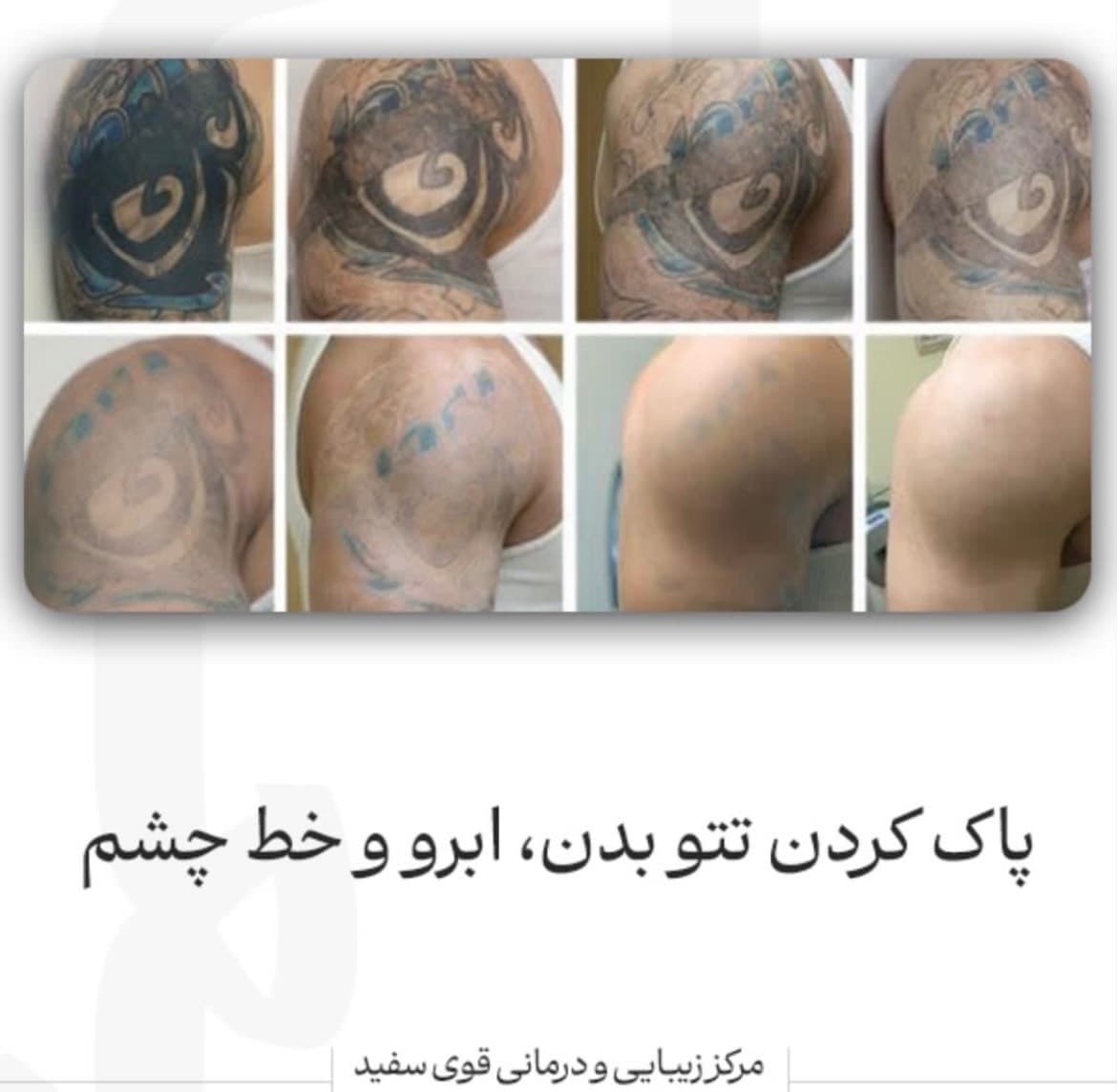 کلینیک زیبایی قوی سفید در مشهد