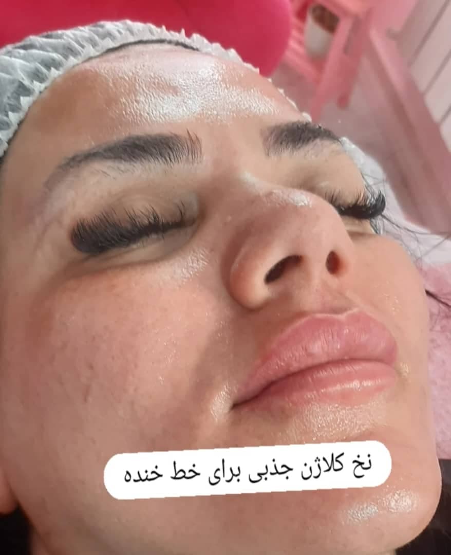 مرکز تخصصی پوست و مو زیبایی مهناز معبود در مهستان