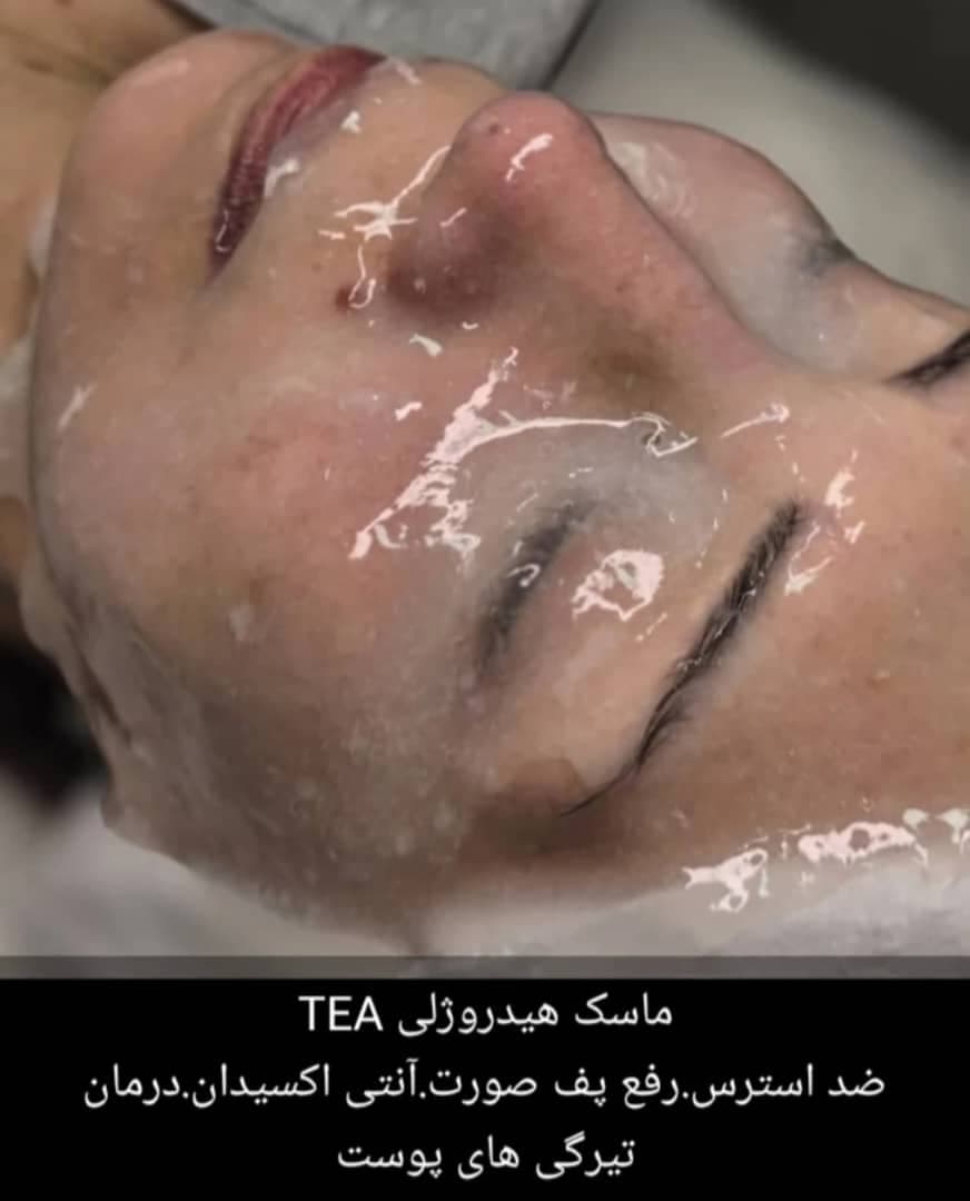 مرکز تخصصی پوست و مو زیبایی مهناز معبود در مهستان