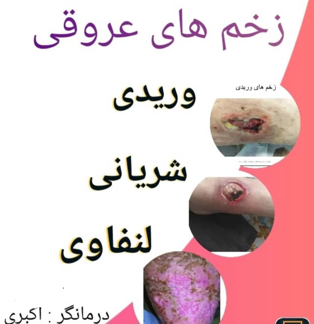 درمان زخم دیابتی و بستر درمانگر زخم طاها اکبری در تبریز