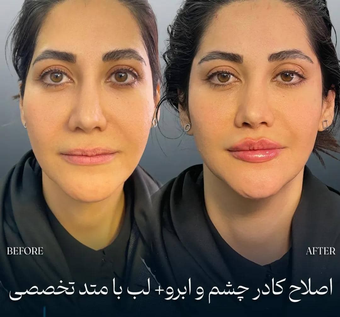 کلینیک زیبایی استار بیوتی سیرجان