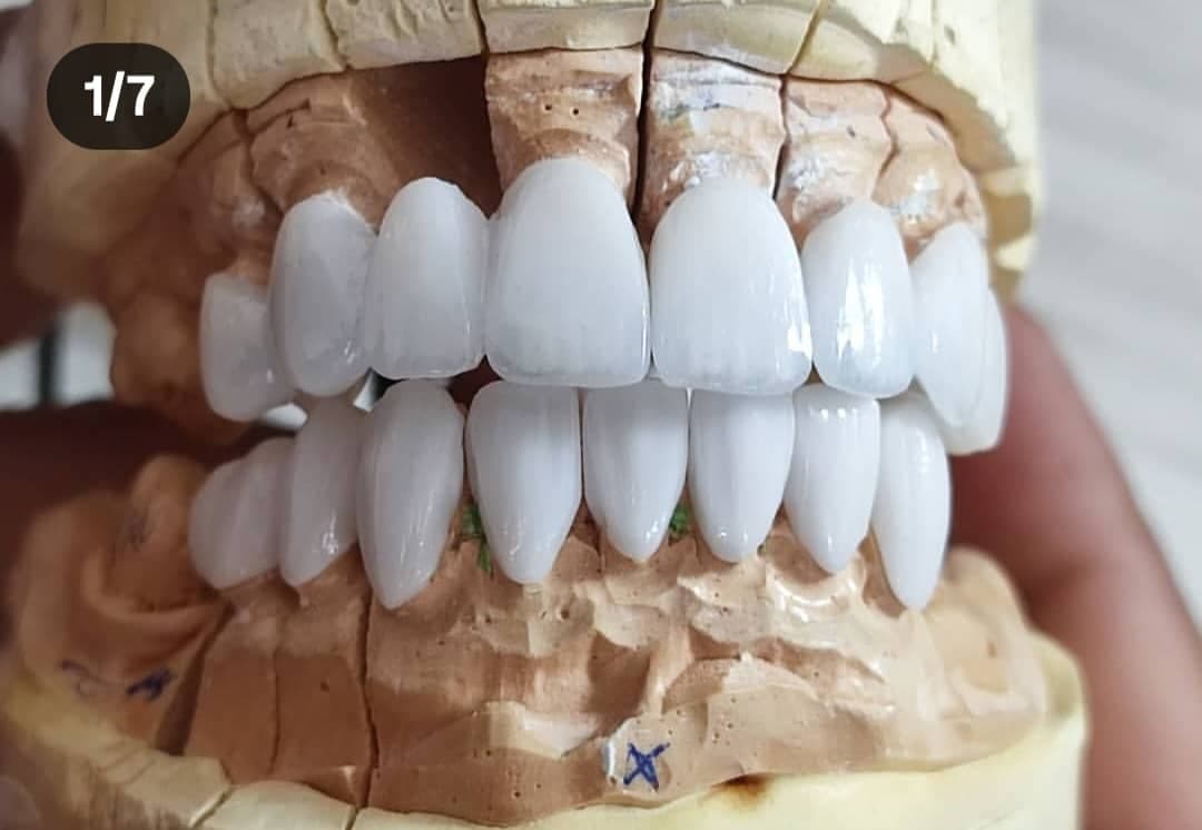 لابراتوار پروتزهای دندانی خدابخش در تبریز