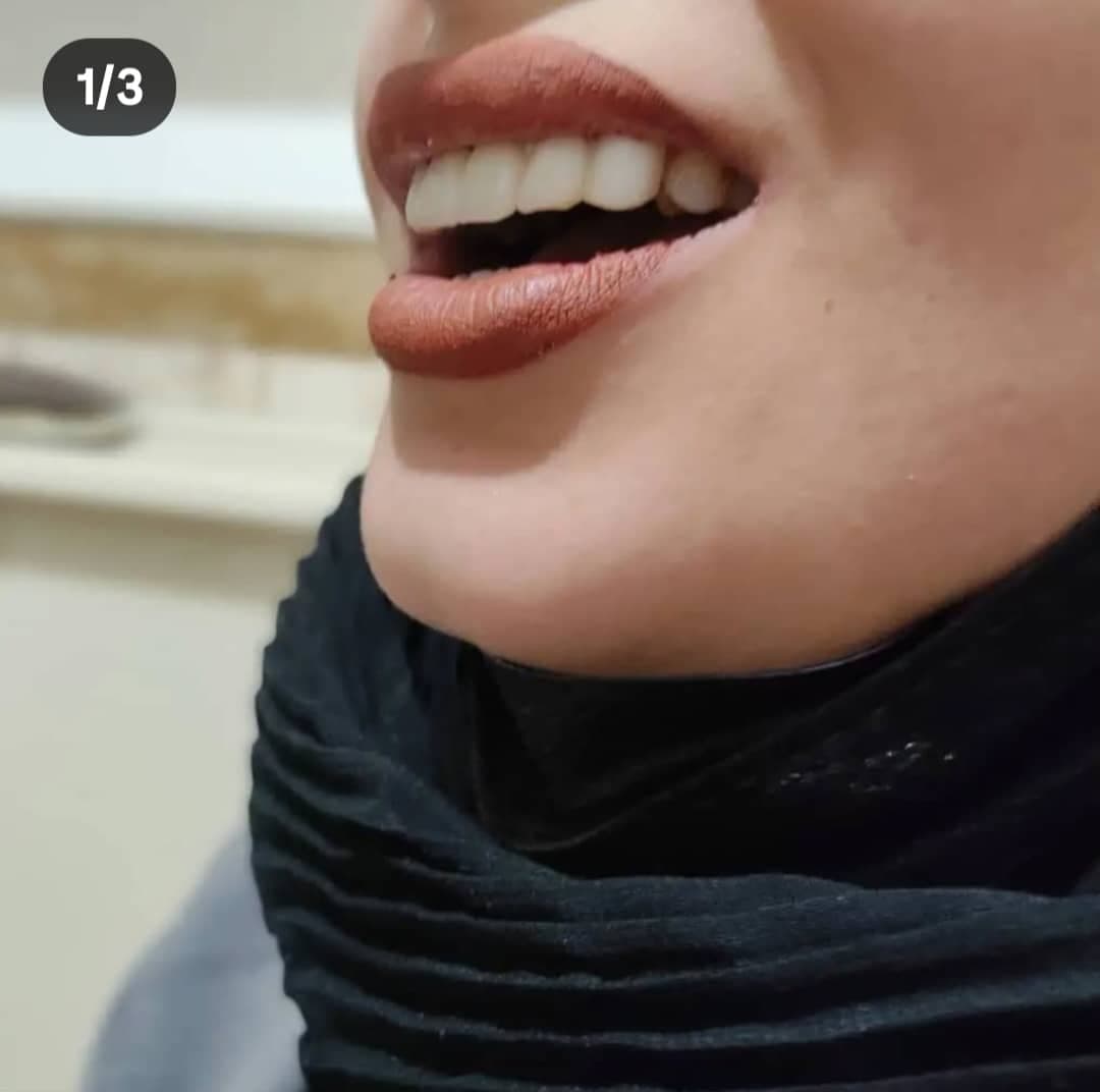 لابراتوار پروتزهای دندانی خدابخش در تبریز