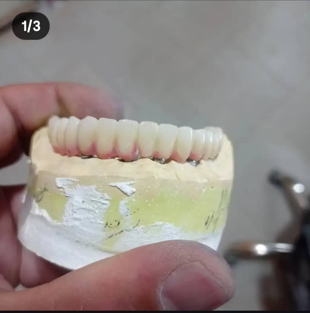 لابراتوار پروتزهای دندانی خدابخش در تبریز