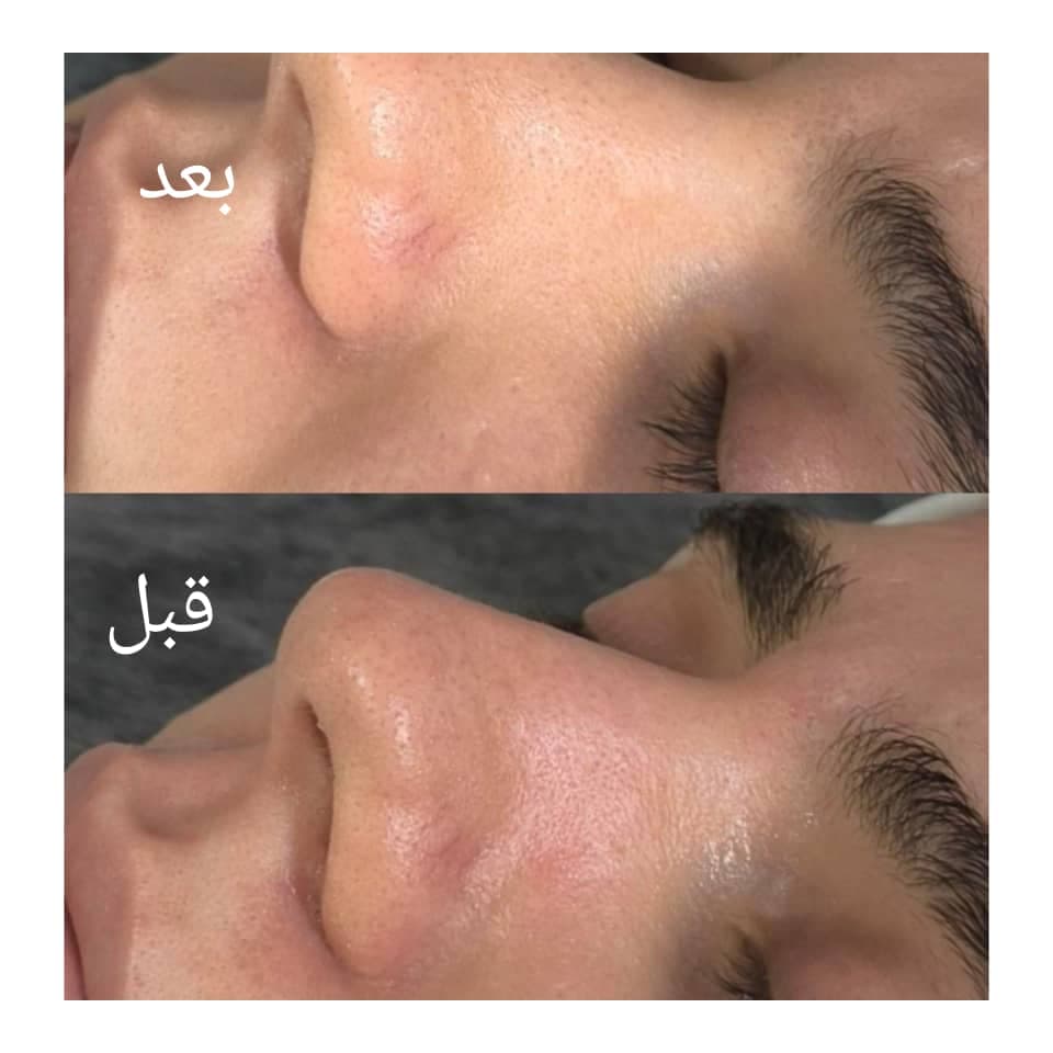 فیشیال و پاکسازی پوست و مو مقدمی در اراک