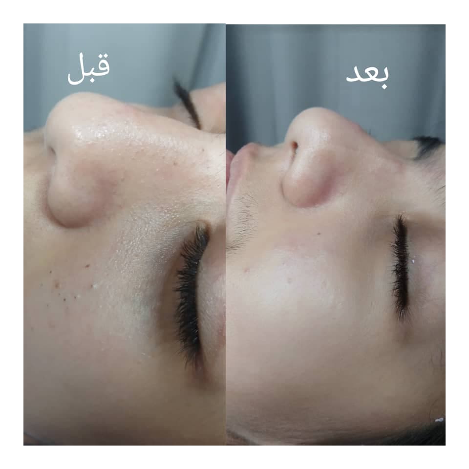 فیشیال و پاکسازی پوست و مو مقدمی در اراک
