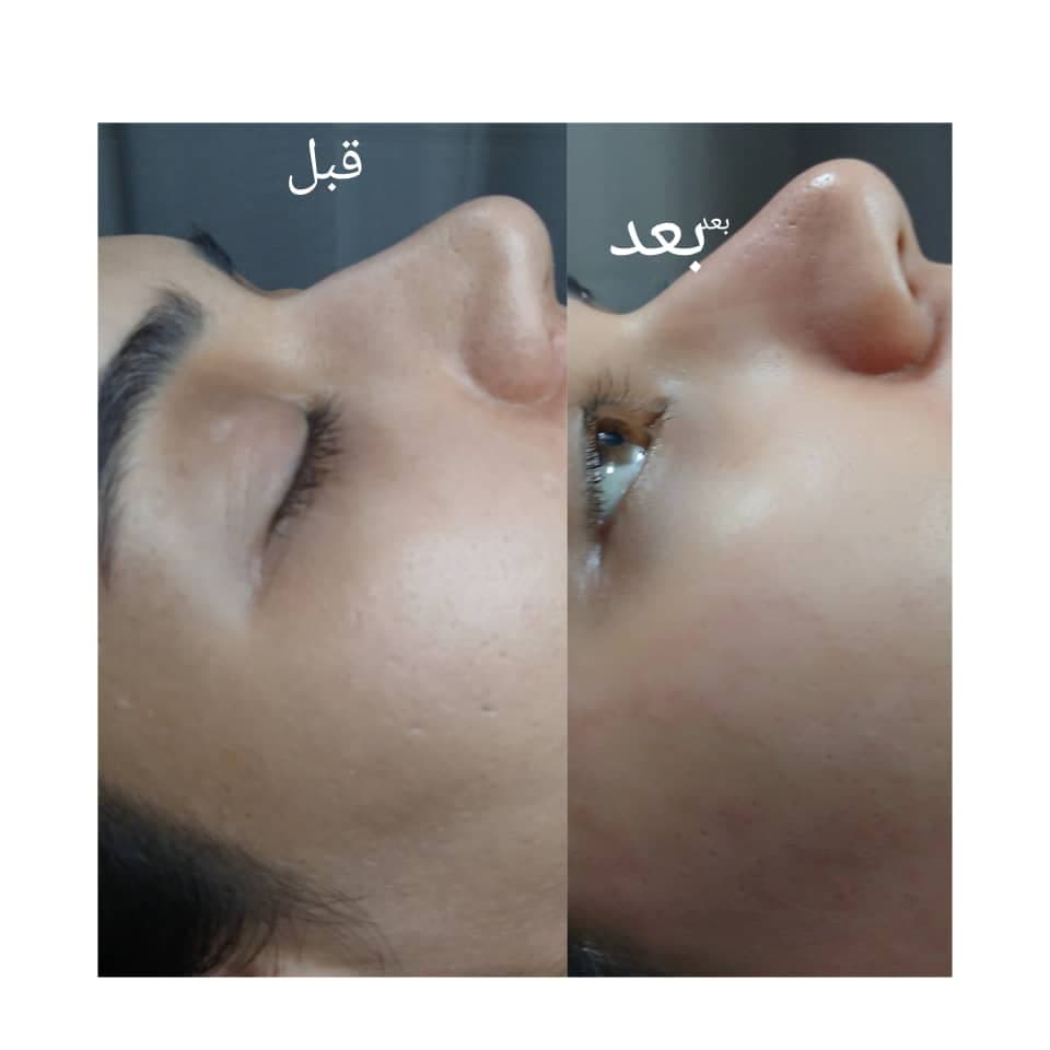 فیشیال و پاکسازی پوست و مو مقدمی در اراک