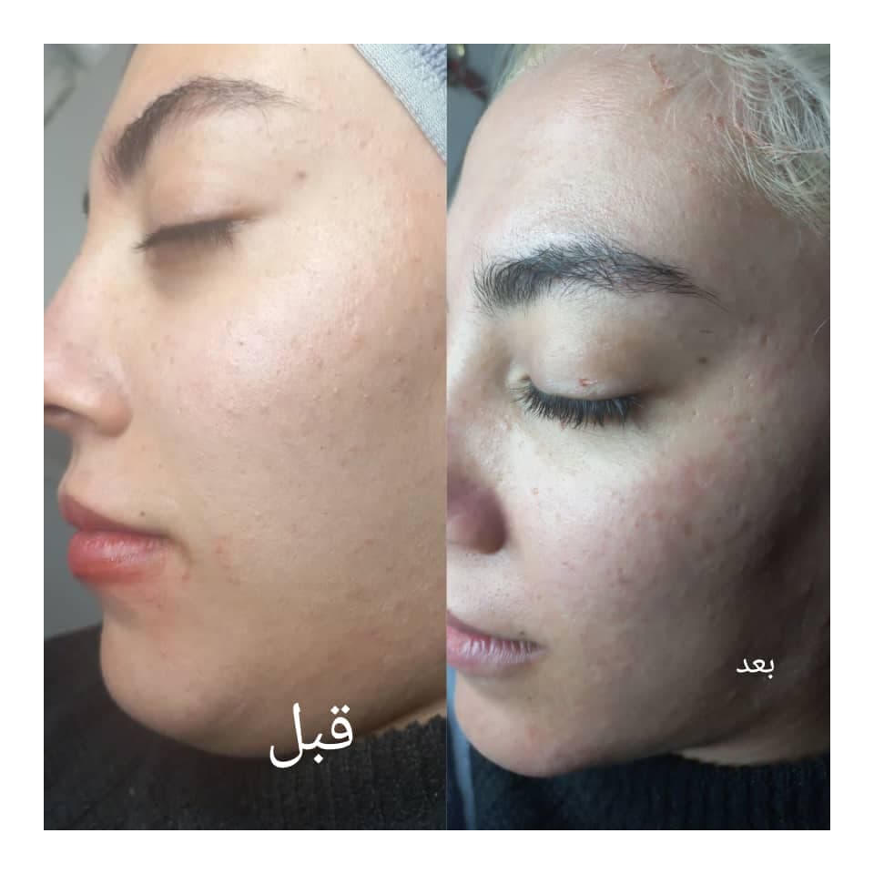 فیشیال و پاکسازی پوست و مو مقدمی در اراک