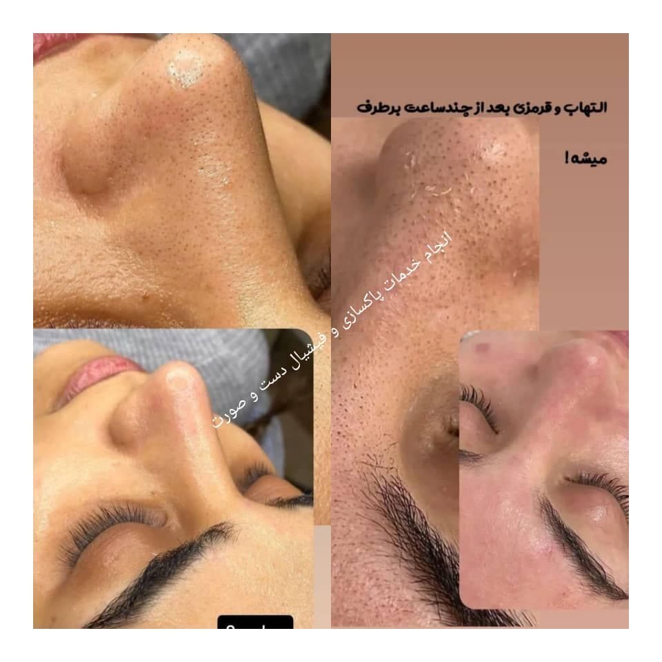 فیشیال و پاکسازی پوست و مو مقدمی در اراک