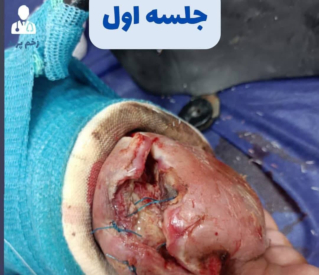 دکتر طاها قادری متخصص زخم پای دیابتی در پرند