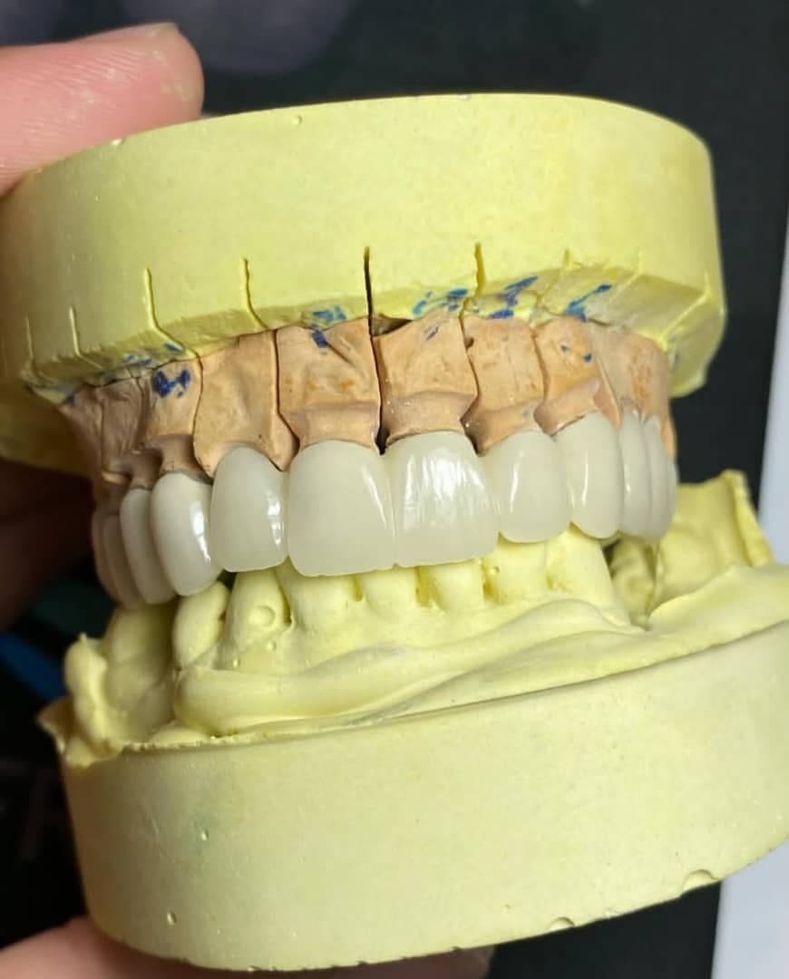 لابراتوار تخصصی پروتزهای دندانی ثابت پادار در ارومیه
